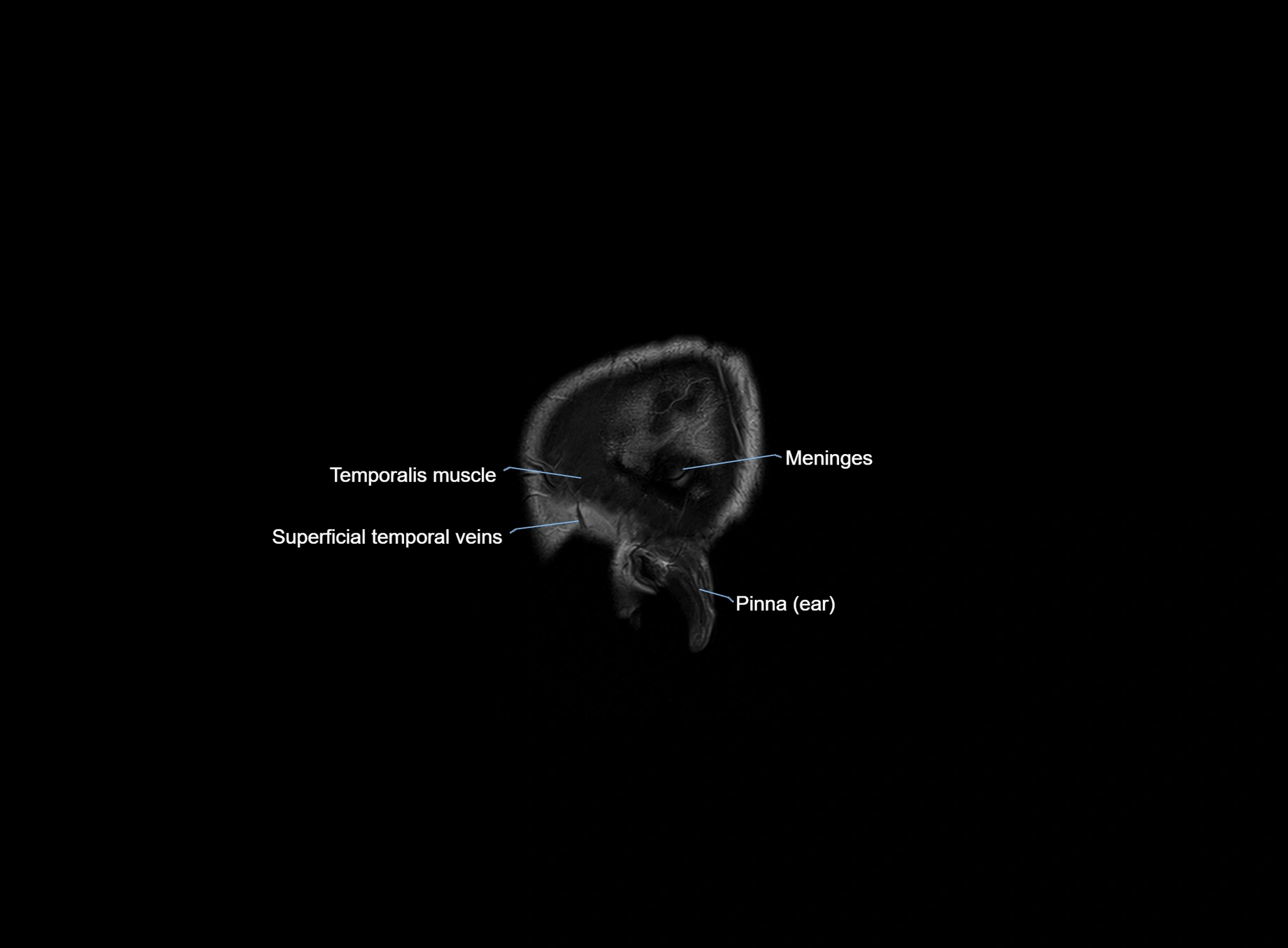 brain sagittal anatomy 3T MRI images -img-00001-00002.webp